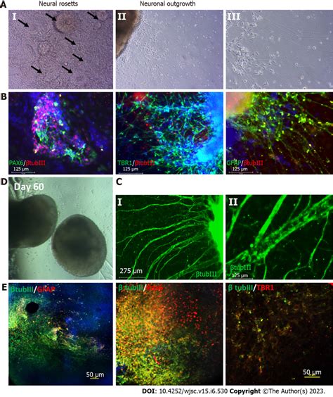 Characterization Of Cortical Organoids For Neural And Astrocyte Marker