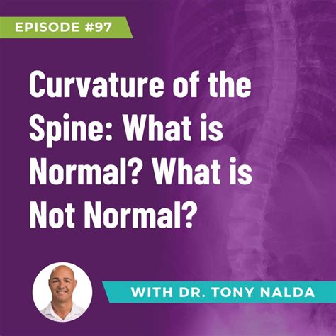 Episode 97: Curvature of the Spine: What is Normal? What is Not Normal?