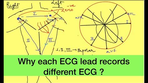 ecg leads placement physiology ekg unipolar  bipolar limb ecg