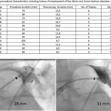 Representative Example Of Cryoballoon Configuration And Pulmonary Vein Download Scientific