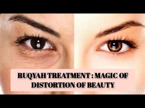 Ruqyah Treatment Distortion Of Beauty Due To Black Magic Evil Eye