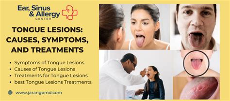 Tongue lesions: Causes, Symptoms, and Treatments – Site Title