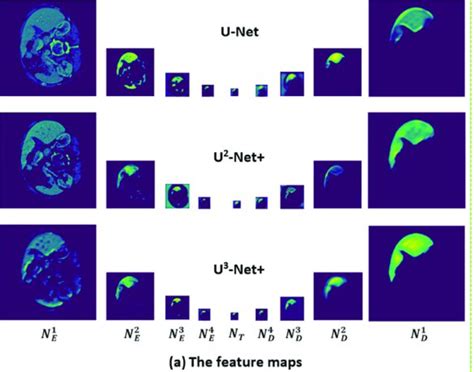 Deep Learning Image Segmentation With U Net Stack Overflow