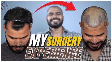 Best Hair Transplant Surgery 2022 Grade 2 Patient Qht Clinic Haridwar India Youtube