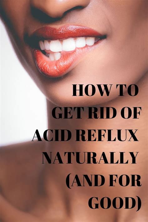 How To Get Rid Of Acid Reflux Naturally Acid Reflux Acid Reflux