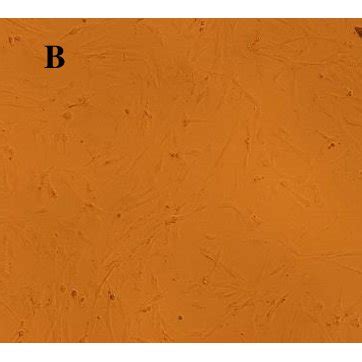 Human Amnion Membrane Derived Mesenchymal Stem Cells Hamscs A On