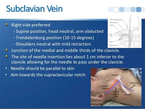 Central Venous Access