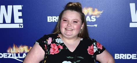 Honey Boo Boo Undergoes Weight Loss Surgery But Is It Legal