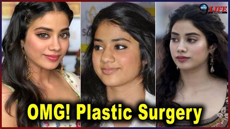 Janhvi Kapoor ने करवाई Plastic Surgery नया लुक उड़ा देगा आपके होश