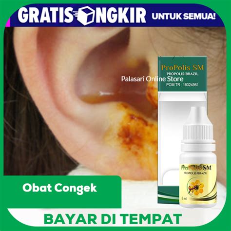 Obat Tetes Telinga Berair Berdenging Infeksi Gatal Bernanah Congek