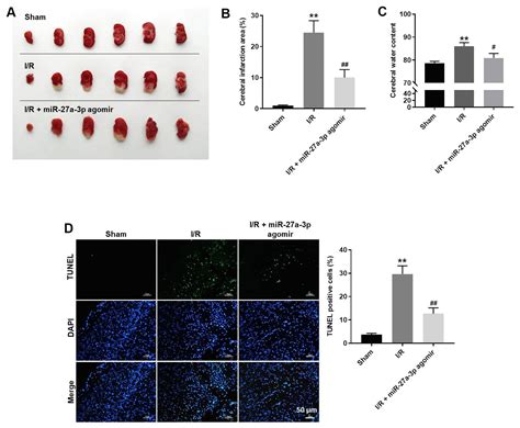 MiR 27a 3p Suppresses Cerebral Ischemia Reperfusion Injury By Targeting