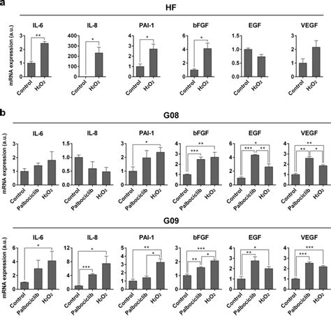 Palbociclib Induces A Senescent Associated Secretory Phenotype In