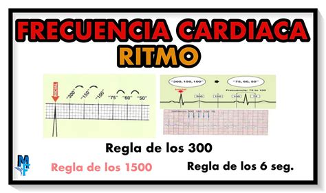 C Mo Calcular La Frecuencia Y Ritmo Card Aco