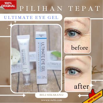 Ultimate Eye Gel Crem Dari Nebi Solusi Untuk Menghilangkan Mata Panda