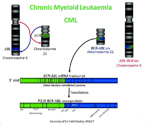 The BCR-ABL-1 reciprocal translocation of chromosomes 9 and 22 in ...