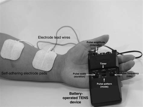 transcutaneous electrical nerve stimulation continuing education