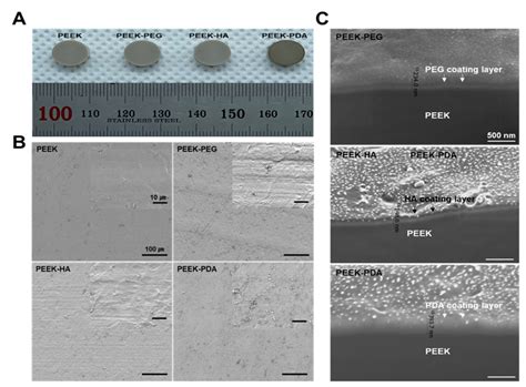 Surface Modification of Polyetheretherketone (PEEK) Intervertebral