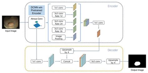 Lightweight Deep Learning Model For Real Time Colorectal Polyp Segmentation