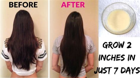 Rapid Length: 7 Days To Long, Luscious Locks