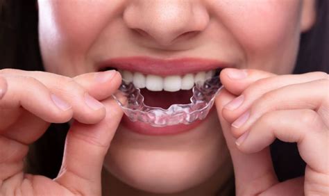 Invisalign Clear Aligners Orthodontics New Zealand