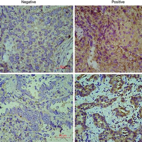 Representative Immunohistochemical Staining Of Er The Images Are