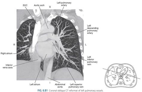 Thorax Sectional Anatomy For Imaging Professionals 4th Edition