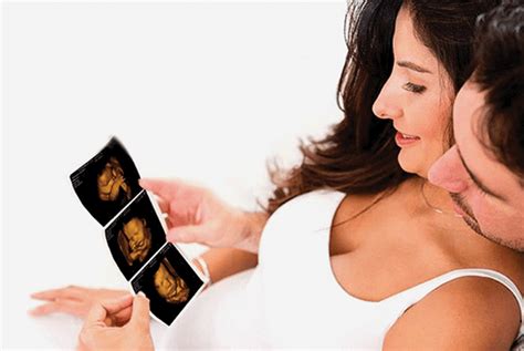 4d Baby Scan Premium Package Private Ultrasound Scans London