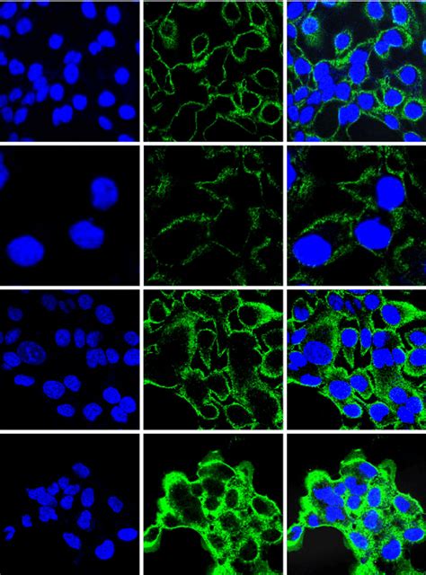 Confocal Microscopic Visualization Of Orp A Cells Were Plated On