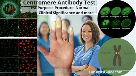 Centromere Antibody Test Test Purpose, Procedure, Normal values ...