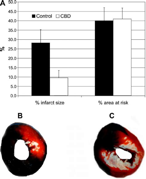 A Percent Area At Risk Of The Left Ventricle Lv And Percent Infarct