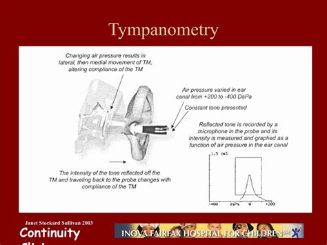 Ppt Tympanometry Powerpoint Presentation Free Download Id 647193