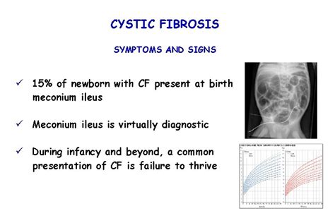 cystic fibrosis   complex metabolic disorder characterized