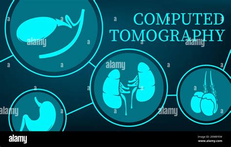 Computed Tomography And Mri Organs Diagnostics Medical Vector Poster