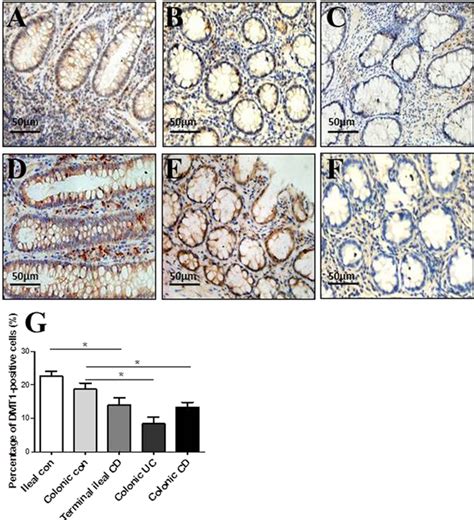 In Situ Expression Of DMT1 In Intestinal Mucosa Representative Frozen