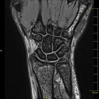 Kernspintomographie MRT Radiologie Bitburg Fabricius Gordon