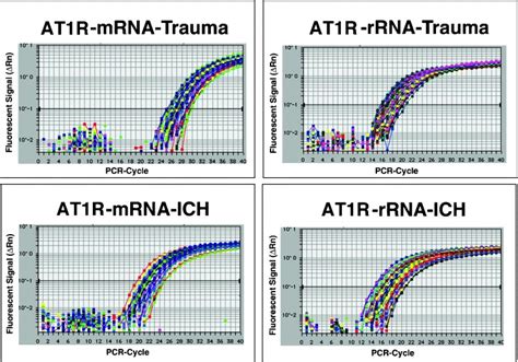 RNA Expression Left Of Angiotensin II Type 1 Receptor AT1R In The