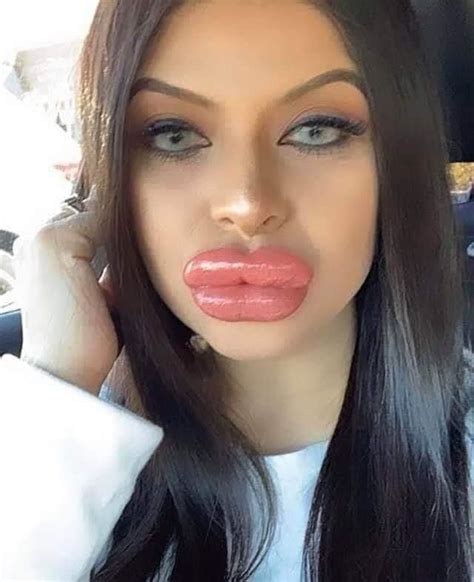 Pin By Jonna On Lips Filler Fake Lips Juicy Lips Beautiful Lips