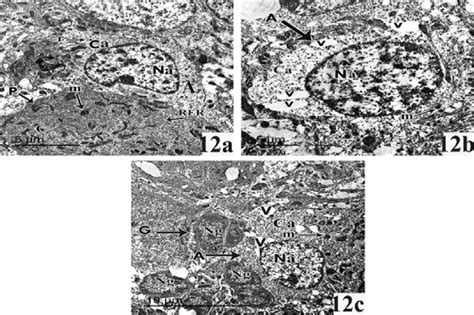 Transmission Electron Micrographs Of Cerebellar Cortex Of Pnd