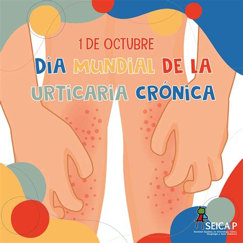 ¿qué Tipos De Urticaria Crónica Existen Seicap