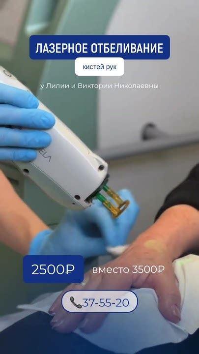 Лазерное отбеливание - YouTube