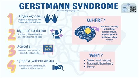 Gerstmann Syndrome Neudrawlogy Simplifying Neurology