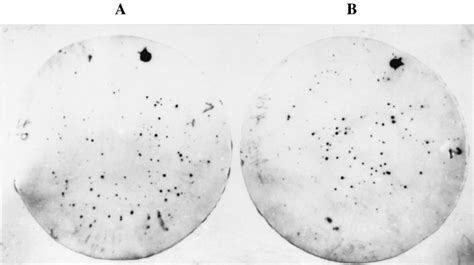 Plaque hybridization. Phage lysates prepared from the lysogens E. coli ...