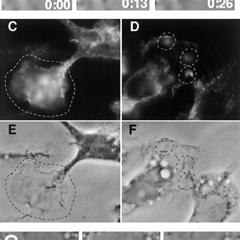 Macropinosome Formation By L Pneumophila Bone Marrowderived