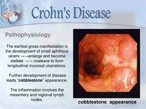 Ppt Dr David Swar Department Of General Surgery Resident Stomach And Colorectal Diseases