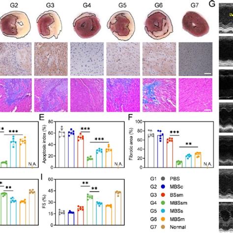 Ncs Mediated Cardioprotection From Myocardial Ir Injury A Ttc Stained