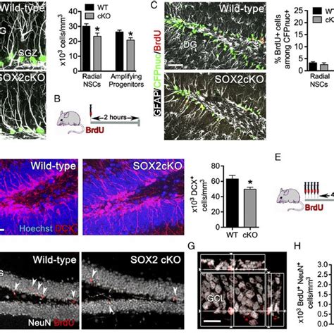 SOX2 Deficiency Leads To Abnormal Newborn Granule Neuron Maturation