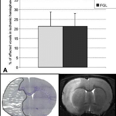 Quantification Of Infarct Size After MCAO Infarct Size Of Rats With