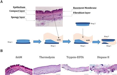 Comparison Of Human Amniotic Membrane Decellularisation Approaches For