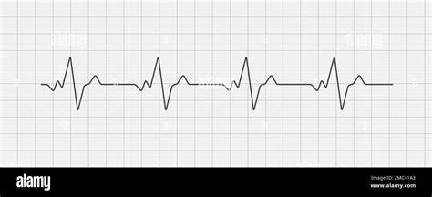 Heartbeat Ecg Electrocardiogram Vector Graph Wave Line Ekg Cardio