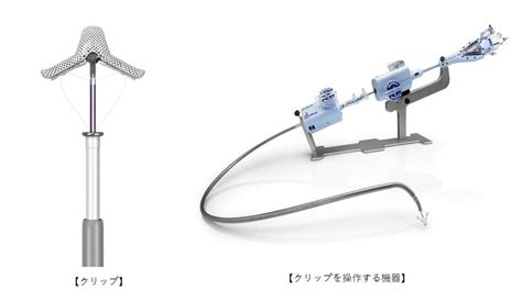 経皮的僧帽弁接合不全修復術mitraclip®（マイトラクリップ）